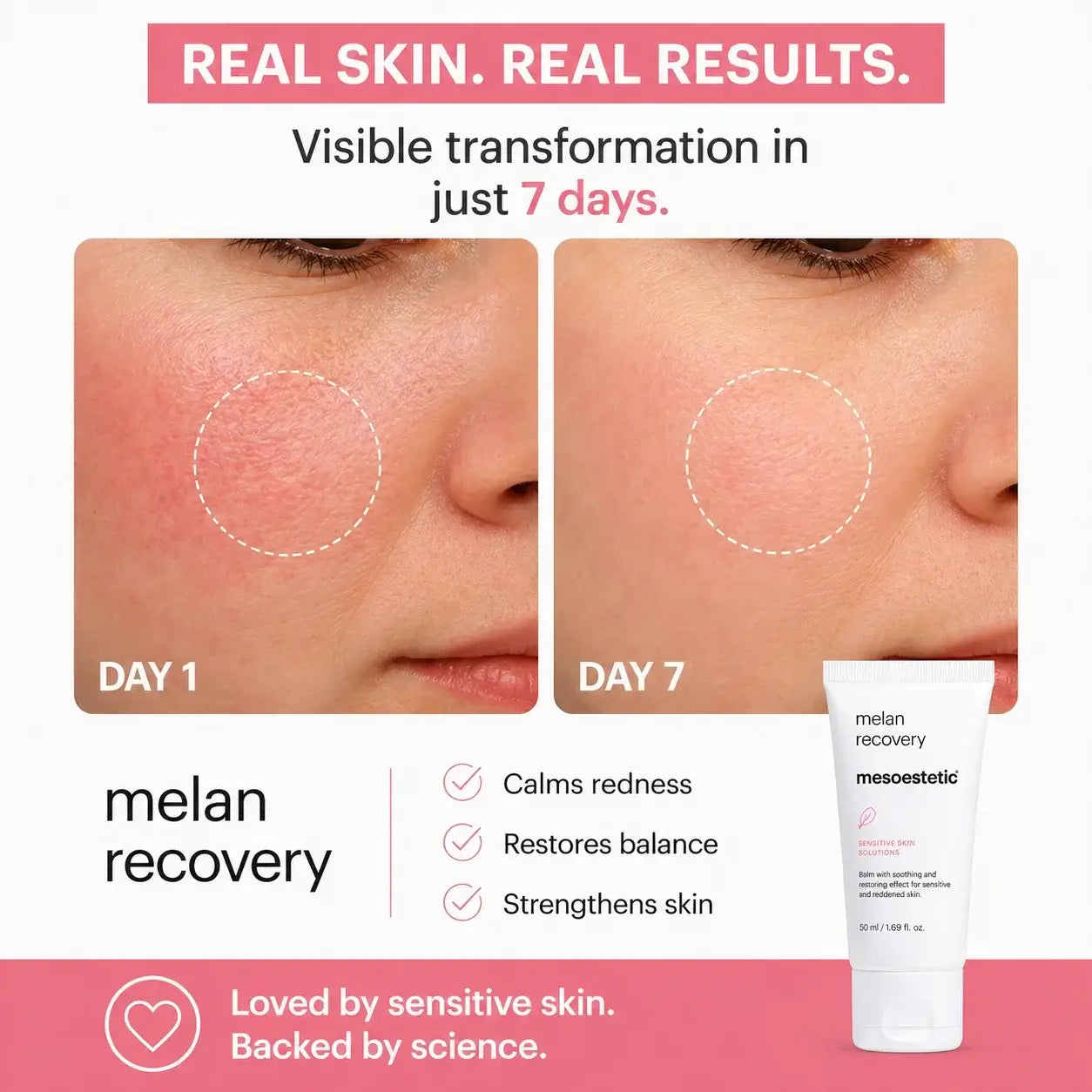 Melan Recovery sunscreen tube shown on a white background with before-and-after skin close-ups demonstrating reduced redness, plus marketing text and product details.