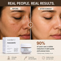 Before-and-after facial skin comparison showing a woman's face with visible acne and uneven tone on the left, and clearer, smoother skin on the right. The image includes the Cosmelan 2 Mesoesthetic product box and jar, with text stating '90% of users saw a visible reduction in dark spots and uneven tone' and icons for clinical proven, dermatologist-trusted, and visible results.