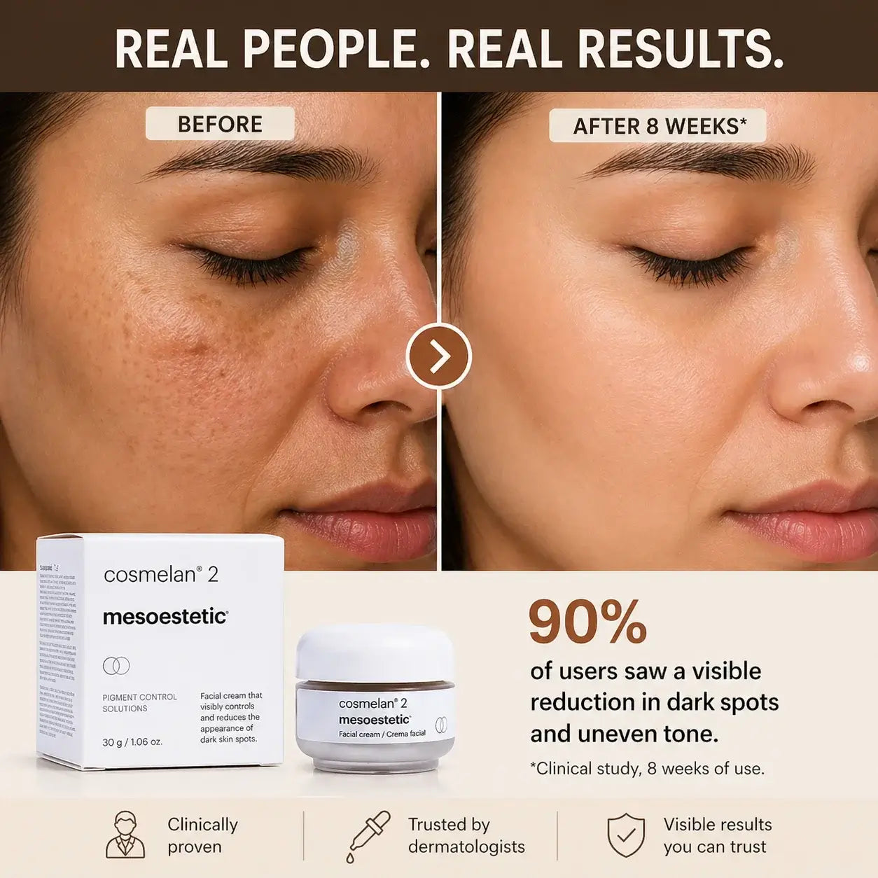 Before-and-after facial skin comparison showing a woman's face with visible acne and uneven tone on the left, and clearer, smoother skin on the right. The image includes the Cosmelan 2 Mesoesthetic product box and jar, with text stating '90% of users saw a visible reduction in dark spots and uneven tone' and icons for clinical proven, dermatologist-trusted, and visible results.