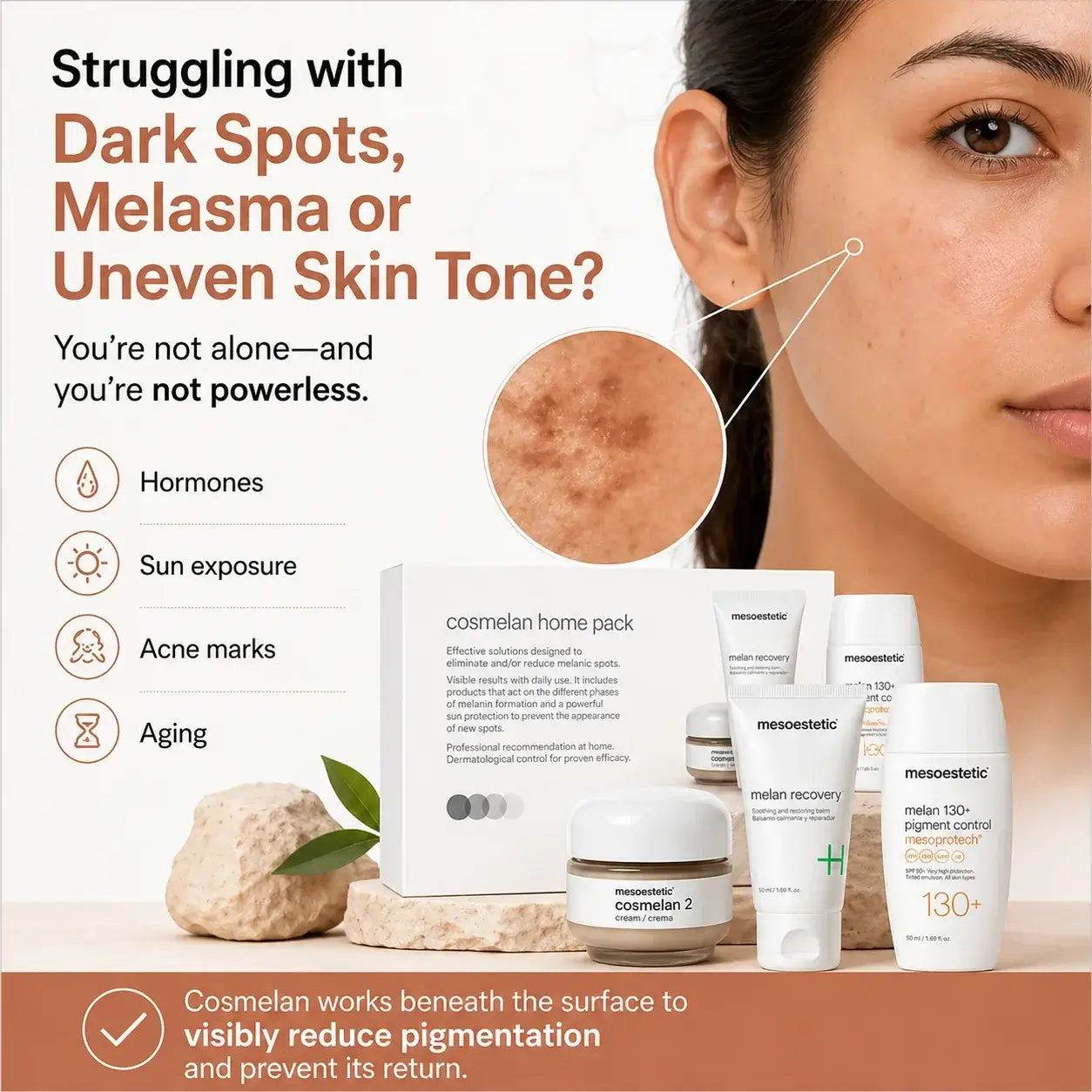 Cosmelan home care set displayed on a beige surface next to a close-up of a woman's face, with text highlighting skin concerns like dark spots, melasma, and uneven skin tone.