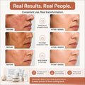 Before and after skin treatment results with visible improvements on a white background.