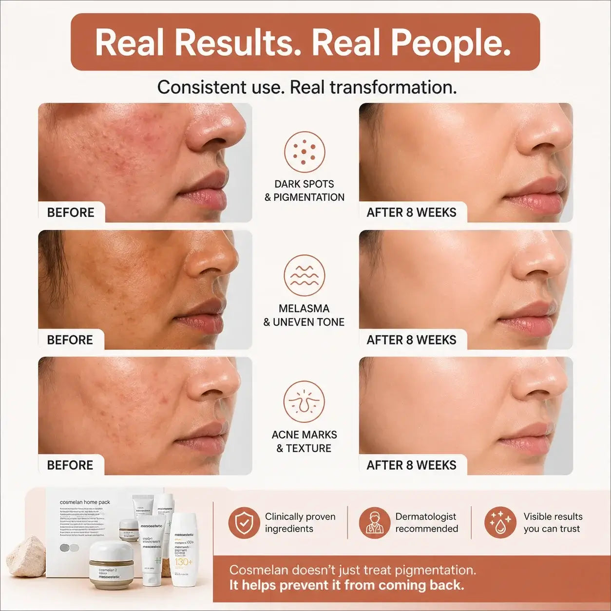 Before and after skin treatment results with visible improvements on a white background.