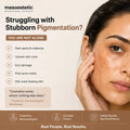 Mesoestetic Cosmelan Pack pigmentation treatment result on skin