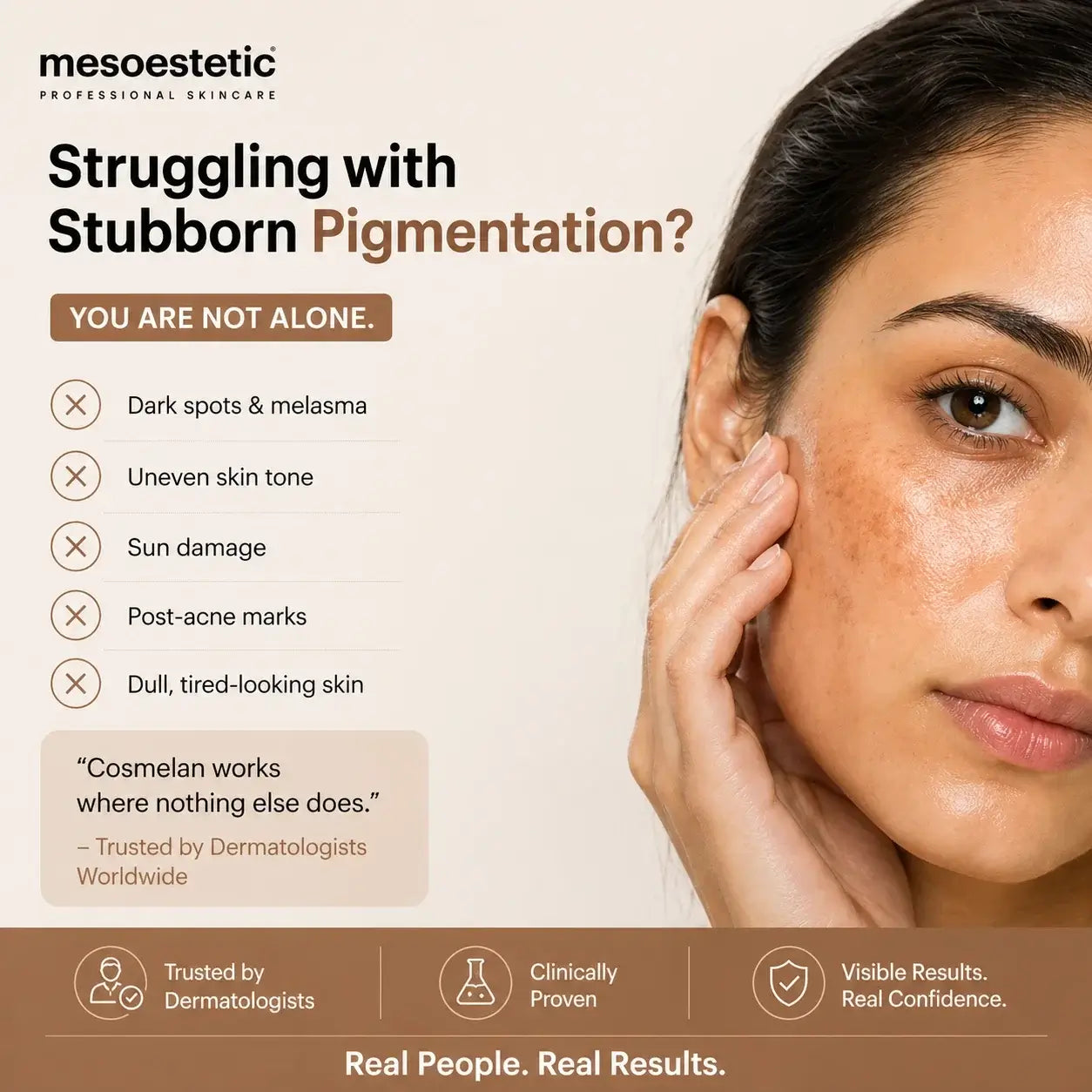 Mesoestetic Cosmelan Pack pigmentation treatment result on skin