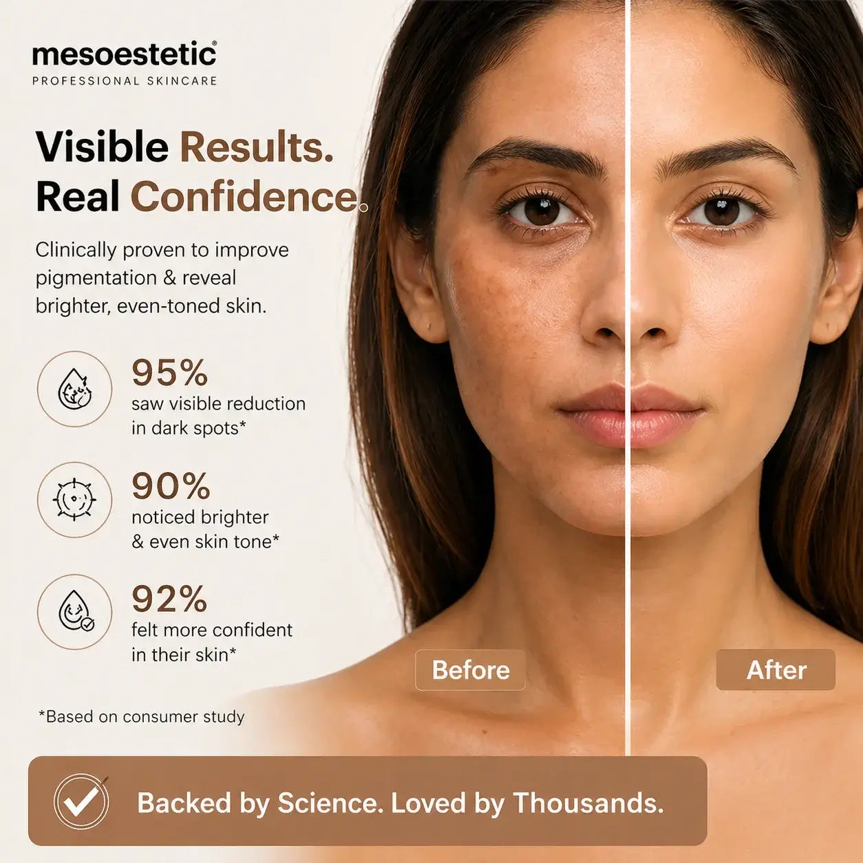 Mesoestetic Cosmelan Pack before and after even-toned skin results