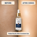 Before-and-after comparison of a face serum on skin, with the left side labeled BEFORE and the right side labeled AFTER 2 WEEKS. A clear glass dropper bottle with a white label and gold collar is centered between the two skin-texture backgrounds.